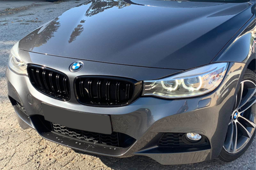 двойни бъбреци BMW F34